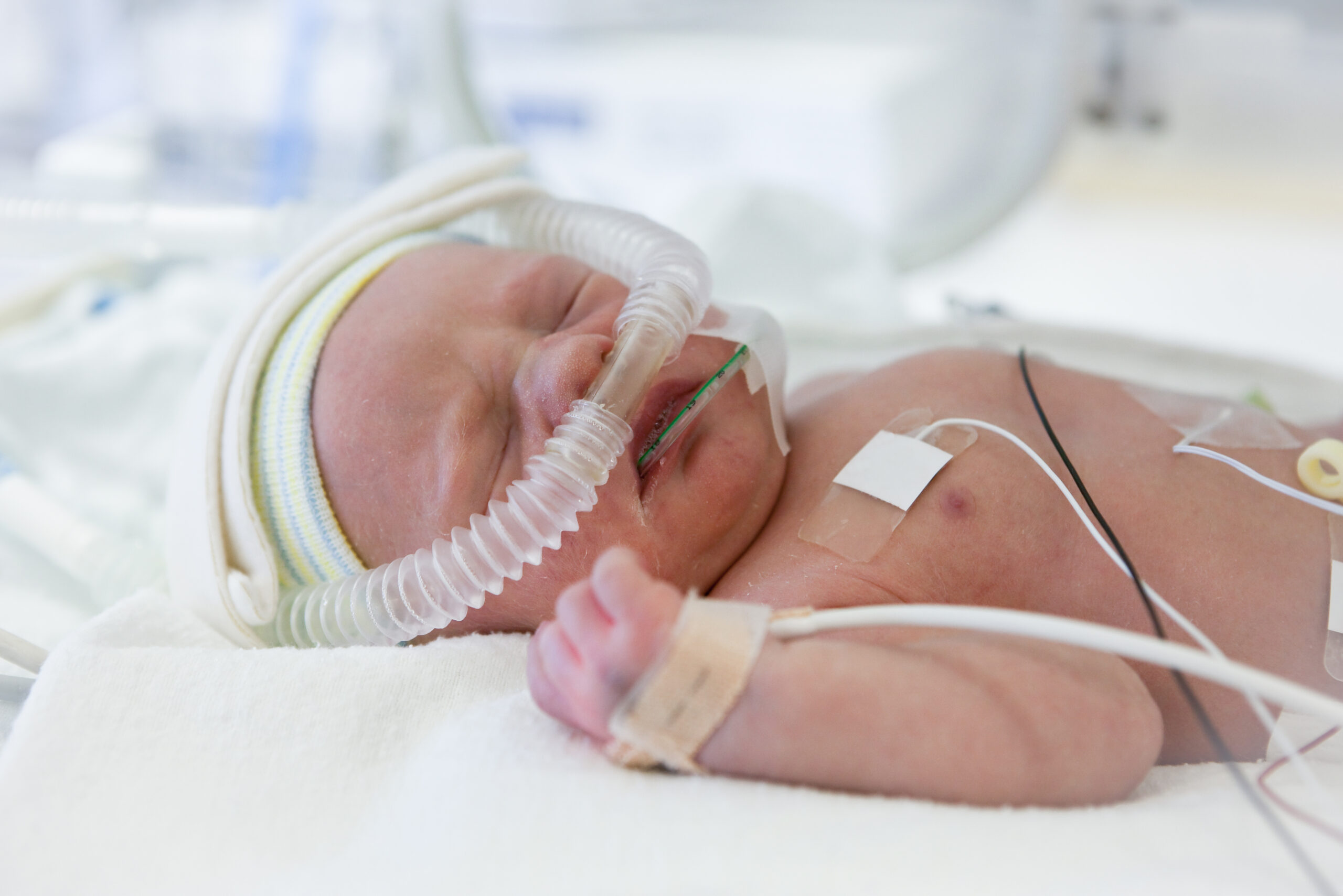 Sunlit Insights into Pediatric Failure to Thrive: A Journey of Growth and Understanding